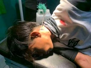 Teror panah mestirius menghantui pengendara sepeda di wilayah Kota Mataram dan Lombok Barat. 24/5/2022.