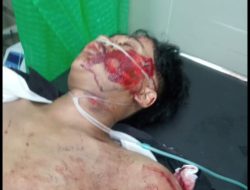 Dugaan Korban Curas Terjadi Lagi di Jln By Pass Bil-Mandalikah.