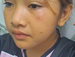 Dugaan Penganiayaan Santri di Ponpes Nw Belogas Bermula dari Saling Ejek